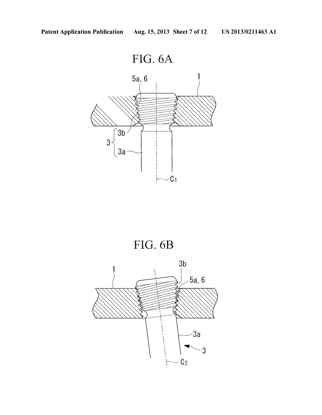 BONE PLATE AND BONE PLATE SYSTEM - diagram, schematic, and image 08