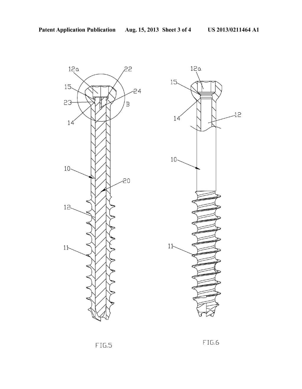 LOCK PIN TYPE CENTRAL NAIL DEVICE - diagram, schematic, and image 04