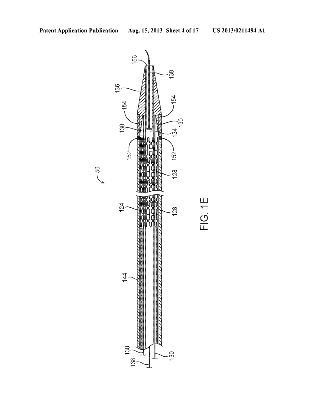 DEVICES AND METHODS FOR CONTROLLING EXPANDABLE PROSTHESES DURING     DEPLOYMENT - diagram, schematic, and image 05