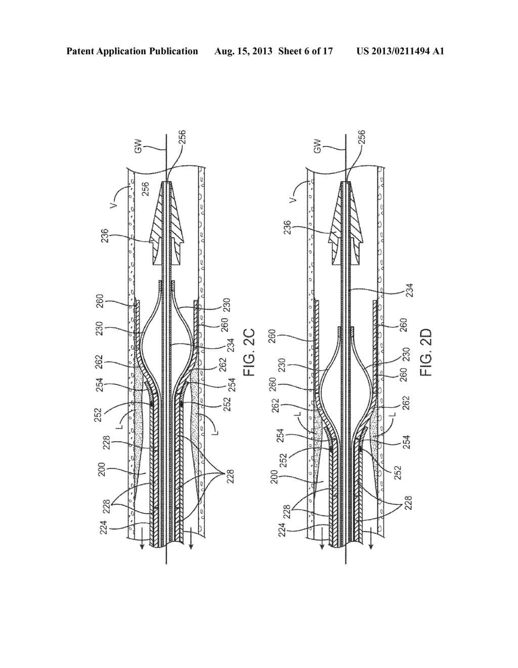 DEVICES AND METHODS FOR CONTROLLING EXPANDABLE PROSTHESES DURING     DEPLOYMENT - diagram, schematic, and image 07