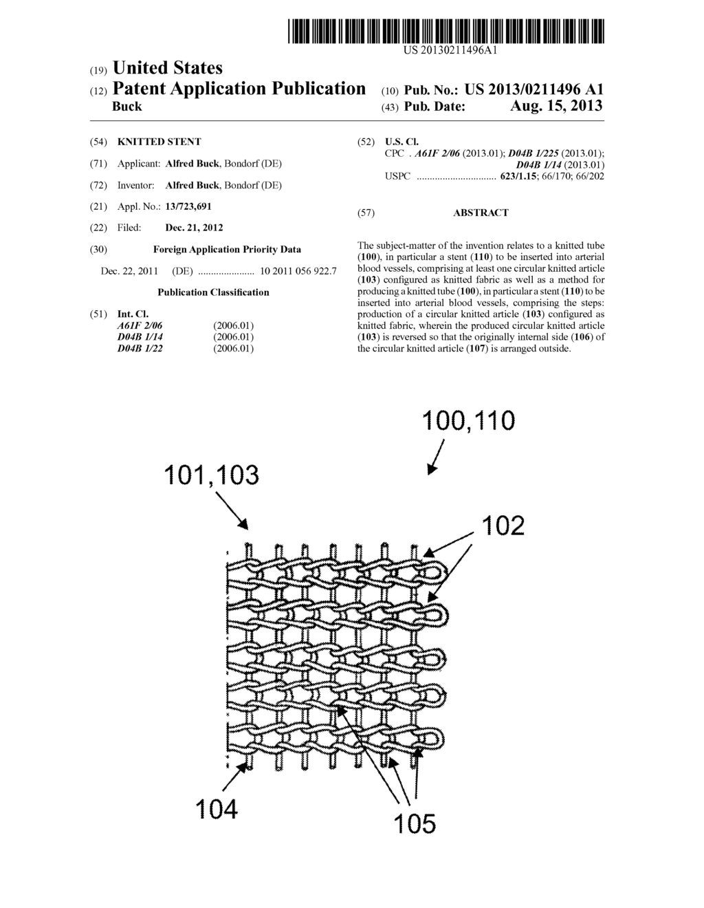 KNITTED STENT - diagram, schematic, and image 01