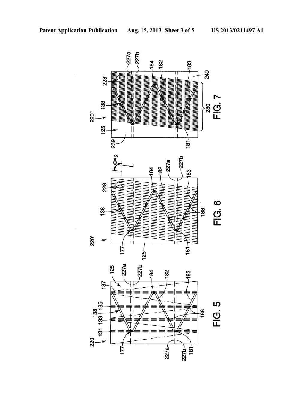 MEDICAL PROSTHESES HAVING BUNDLED AND NON-BUNDLED REGIONS - diagram, schematic, and image 04