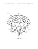 SEQUENTIALLY DEPLOYED TRANSCATHETER MITRAL VALVE PROSTHESIS diagram and image