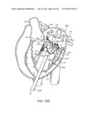 SEQUENTIALLY DEPLOYED TRANSCATHETER MITRAL VALVE PROSTHESIS diagram and image