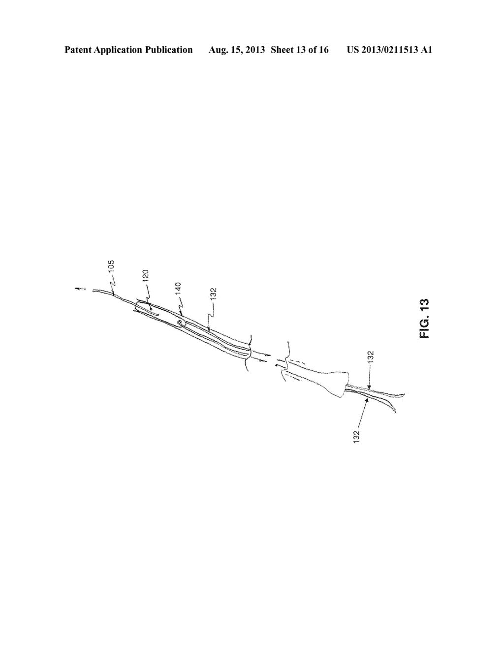 METHOD AND APPARATUS FOR REPAIRING A MITRAL VALVE - diagram, schematic, and image 14