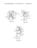 Method and Apparatus for Altering Biomechanics of the Articular Joints diagram and image