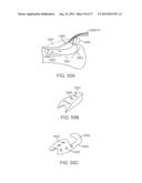 Method and Apparatus for Altering Biomechanics of the Articular Joints diagram and image