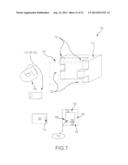 MULTI-PIECE MACHINE GRAFT SYSTEMS AND METHODS diagram and image