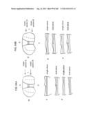 PATIENT-ADAPTED AND IMPROVED ARTICULAR IMPLANTS, DESIGNS AND RELATED GUIDE     TOOLS diagram and image