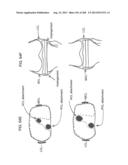 PATIENT-ADAPTED AND IMPROVED ARTICULAR IMPLANTS, DESIGNS AND RELATED GUIDE     TOOLS diagram and image