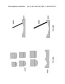 PATIENT-ADAPTED AND IMPROVED ARTICULAR IMPLANTS, DESIGNS AND RELATED GUIDE     TOOLS diagram and image