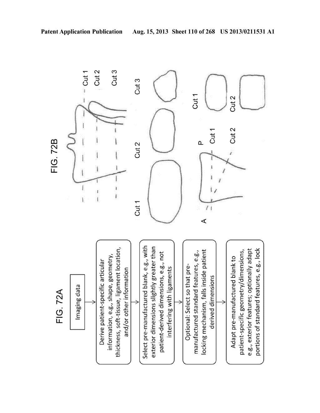 PATIENT-ADAPTED AND IMPROVED ARTICULAR IMPLANTS, DESIGNS AND RELATED GUIDE     TOOLS - diagram, schematic, and image 111