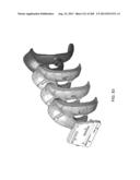 PATIENT-ADAPTED AND IMPROVED ARTICULAR IMPLANTS, DESIGNS AND RELATED GUIDE     TOOLS diagram and image