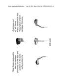 PATIENT-ADAPTED AND IMPROVED ARTICULAR IMPLANTS, DESIGNS AND RELATED GUIDE     TOOLS diagram and image