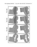 PATIENT-ADAPTED AND IMPROVED ARTICULAR IMPLANTS, DESIGNS AND RELATED GUIDE     TOOLS diagram and image