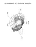 PATIENT-ADAPTED AND IMPROVED ARTICULAR IMPLANTS, DESIGNS AND RELATED GUIDE     TOOLS diagram and image