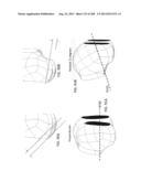 PATIENT-ADAPTED AND IMPROVED ARTICULAR IMPLANTS, DESIGNS AND RELATED GUIDE     TOOLS diagram and image