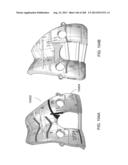 PATIENT-ADAPTED AND IMPROVED ARTICULAR IMPLANTS, DESIGNS AND RELATED GUIDE     TOOLS diagram and image