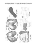 PATIENT-ADAPTED AND IMPROVED ARTICULAR IMPLANTS, DESIGNS AND RELATED GUIDE     TOOLS diagram and image