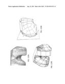 PATIENT-ADAPTED AND IMPROVED ARTICULAR IMPLANTS, DESIGNS AND RELATED GUIDE     TOOLS diagram and image