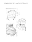 PATIENT-ADAPTED AND IMPROVED ARTICULAR IMPLANTS, DESIGNS AND RELATED GUIDE     TOOLS diagram and image