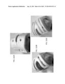 PATIENT-ADAPTED AND IMPROVED ARTICULAR IMPLANTS, DESIGNS AND RELATED GUIDE     TOOLS diagram and image