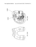 PATIENT-ADAPTED AND IMPROVED ARTICULAR IMPLANTS, DESIGNS AND RELATED GUIDE     TOOLS diagram and image