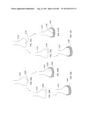 PATIENT-ADAPTED AND IMPROVED ARTICULAR IMPLANTS, DESIGNS AND RELATED GUIDE     TOOLS diagram and image