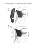 PATIENT-ADAPTED AND IMPROVED ARTICULAR IMPLANTS, DESIGNS AND RELATED GUIDE     TOOLS diagram and image