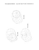 PATIENT-ADAPTED AND IMPROVED ARTICULAR IMPLANTS, DESIGNS AND RELATED GUIDE     TOOLS diagram and image