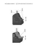 PATIENT-ADAPTED AND IMPROVED ARTICULAR IMPLANTS, DESIGNS AND RELATED GUIDE     TOOLS diagram and image