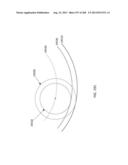 PATIENT-ADAPTED AND IMPROVED ARTICULAR IMPLANTS, DESIGNS AND RELATED GUIDE     TOOLS diagram and image