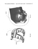 PATIENT-ADAPTED AND IMPROVED ARTICULAR IMPLANTS, DESIGNS AND RELATED GUIDE     TOOLS diagram and image