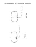 PATIENT-ADAPTED AND IMPROVED ARTICULAR IMPLANTS, DESIGNS AND RELATED GUIDE     TOOLS diagram and image