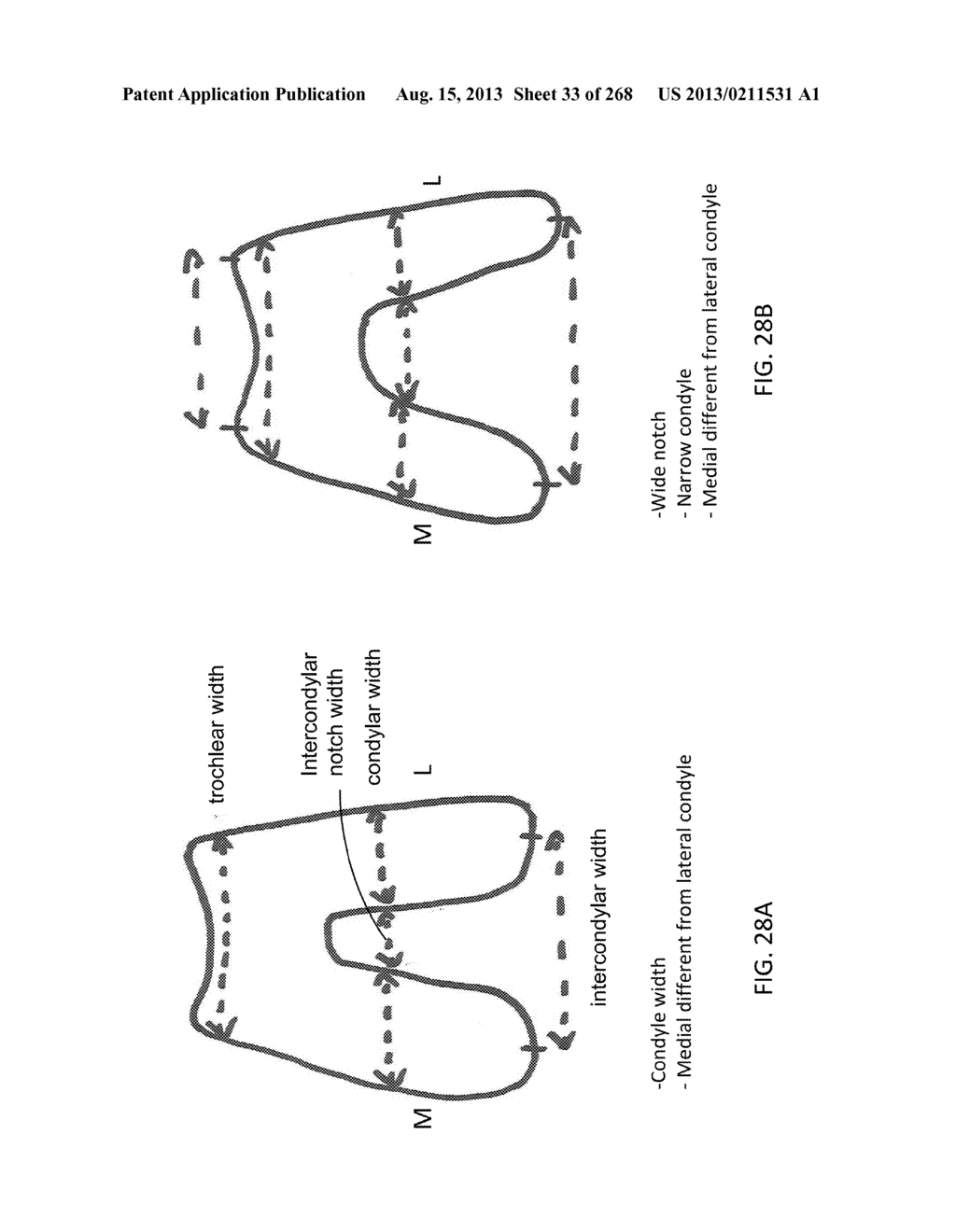 PATIENT-ADAPTED AND IMPROVED ARTICULAR IMPLANTS, DESIGNS AND RELATED GUIDE     TOOLS - diagram, schematic, and image 34