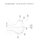 PATIENT-ADAPTED AND IMPROVED ARTICULAR IMPLANTS, DESIGNS AND RELATED GUIDE     TOOLS diagram and image