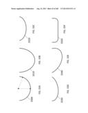 PATIENT-ADAPTED AND IMPROVED ARTICULAR IMPLANTS, DESIGNS AND RELATED GUIDE     TOOLS diagram and image