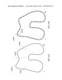 PATIENT-ADAPTED AND IMPROVED ARTICULAR IMPLANTS, DESIGNS AND RELATED GUIDE     TOOLS diagram and image