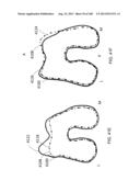 PATIENT-ADAPTED AND IMPROVED ARTICULAR IMPLANTS, DESIGNS AND RELATED GUIDE     TOOLS diagram and image