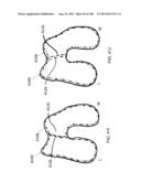 PATIENT-ADAPTED AND IMPROVED ARTICULAR IMPLANTS, DESIGNS AND RELATED GUIDE     TOOLS diagram and image