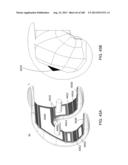 PATIENT-ADAPTED AND IMPROVED ARTICULAR IMPLANTS, DESIGNS AND RELATED GUIDE     TOOLS diagram and image