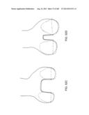 PATIENT-ADAPTED AND IMPROVED ARTICULAR IMPLANTS, DESIGNS AND RELATED GUIDE     TOOLS diagram and image