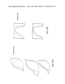 PATIENT-ADAPTED AND IMPROVED ARTICULAR IMPLANTS, DESIGNS AND RELATED GUIDE     TOOLS diagram and image