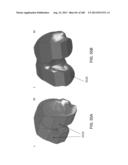 PATIENT-ADAPTED AND IMPROVED ARTICULAR IMPLANTS, DESIGNS AND RELATED GUIDE     TOOLS diagram and image