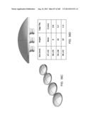 PATIENT-ADAPTED AND IMPROVED ARTICULAR IMPLANTS, DESIGNS AND RELATED GUIDE     TOOLS diagram and image