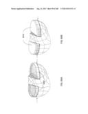 PATIENT-ADAPTED AND IMPROVED ARTICULAR IMPLANTS, DESIGNS AND RELATED GUIDE     TOOLS diagram and image