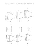 PATIENT-ADAPTED AND IMPROVED ARTICULAR IMPLANTS, DESIGNS AND RELATED GUIDE     TOOLS diagram and image