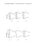 PATIENT-ADAPTED AND IMPROVED ARTICULAR IMPLANTS, DESIGNS AND RELATED GUIDE     TOOLS diagram and image