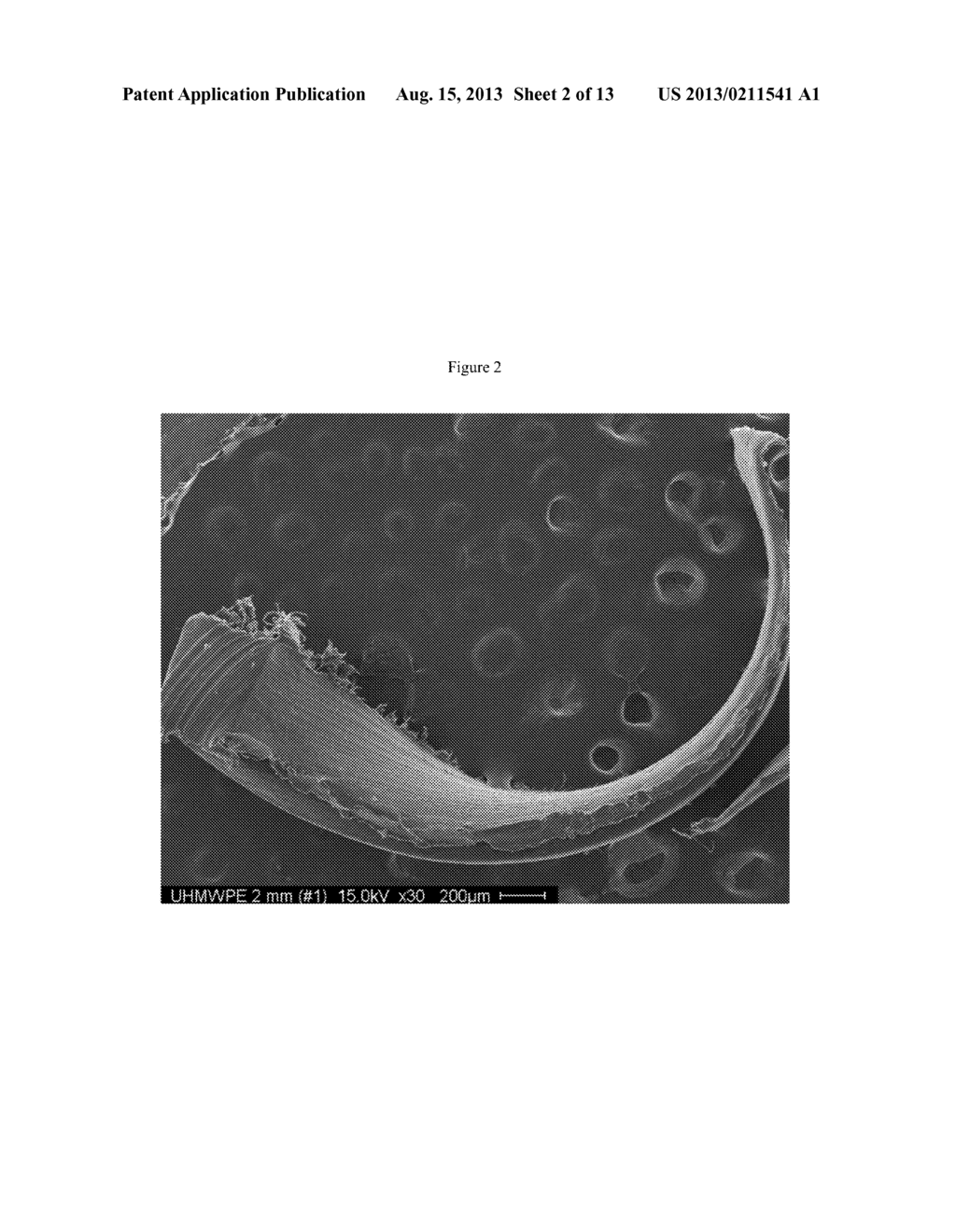 Porous Implant Materials and Related Methods - diagram, schematic, and image 03