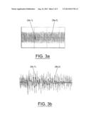 METHOD FOR THE CONTINUOUS MONITORING AND DIAGNOSIS OF SOURCES OF PARTIAL     DISCHARGES (PDs) IN HIGH VOLTAGE CABLES DURING CONNECTION TO, AND     OPERATION IN THE POWER GRID, AND PHYSICAL SYSTEM FOR CARRYING OUT SAME diagram and image